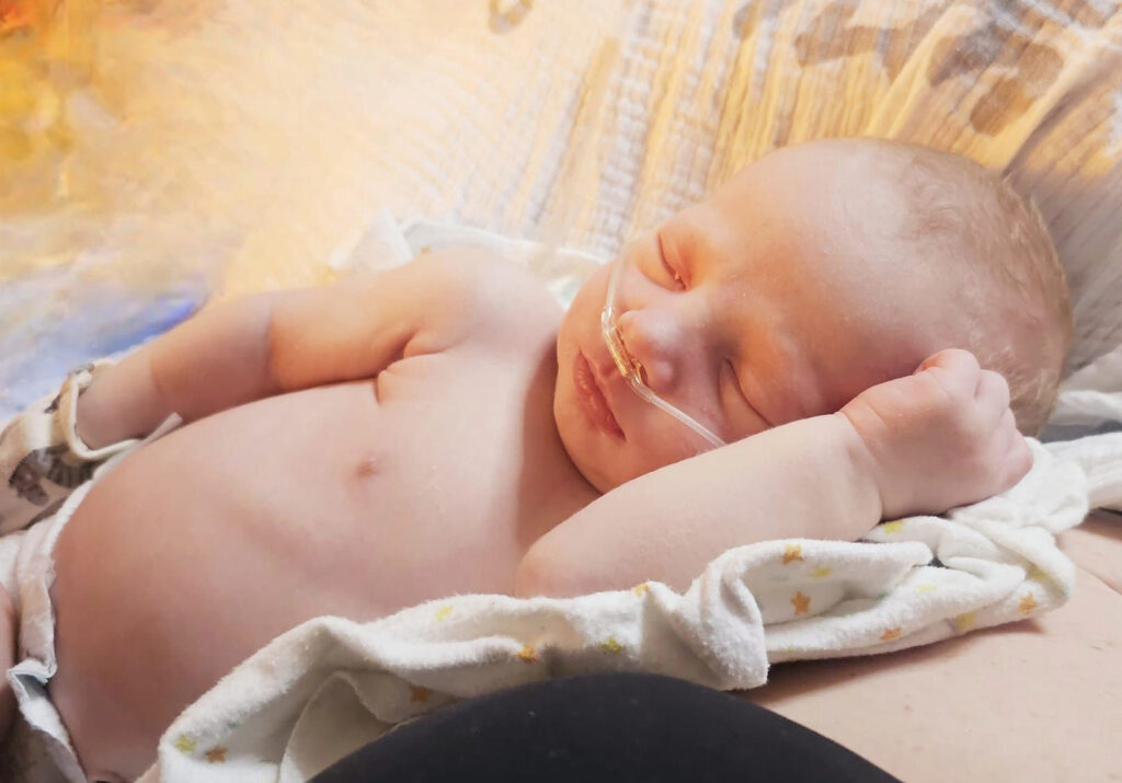 A shirtless baby laying on blankets with breathing tube in his nose