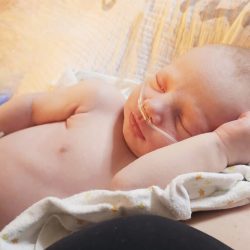 A shirtless baby laying on blankets with breathing tube in his nose